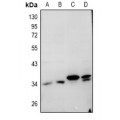 LifeSab™ Cathepsin L Rabbit pAb (50 µl)