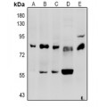 LifeSab™ Factor II Rabbit pAb (50 µl)