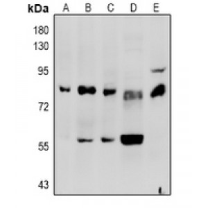LifeSab™ Factor II Rabbit pAb (50 µl)