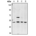 LifeSab™ Amphiphysin 2 Rabbit pAb (50 µl)
