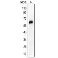 LifeSab™ SMAD2 Rabbit pAb (50 µl)