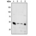 LifeSab™ Synaptotagmin (pT202/199) Rabbit pAb (50 µl)