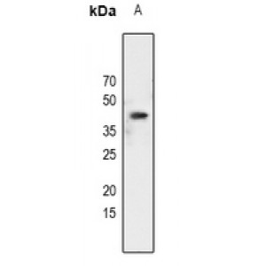 LifeSab™ C/EBP alpha (pS21) Rabbit pAb (50 µl)