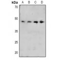 LifeSab™ CRK (pY221) Rabbit pAb (50 µl)