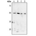 LifeSab™ MK2 (pT222) Rabbit pAb (50 µl)