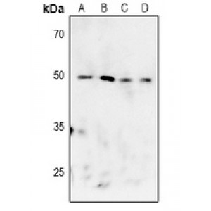 LifeSab™ MK2 (pT222) Rabbit pAb (50 µl)