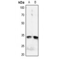 LifeSab™ IGFBP3 (pS183) Rabbit pAb (50 µl)