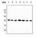 LifeSab™ C/EBP alpha Rabbit pAb (50 µl)