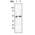 LifeSab™ CCR5 Rabbit pAb (50 µl)