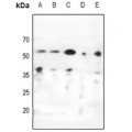LifeSab™ CHK1 Rabbit pAb (50 µl)