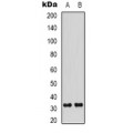 LifeSab™ Cyclin D3 (pT283) Rabbit pAb (50 µl)