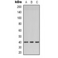 LifeSab™ HSD3B7 Rabbit pAb (50 µl)