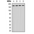 LifeSab™ PLC gamma 1 Rabbit pAb (50 µl)