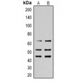 LifeSab™ SHCA (pY427) Rabbit pAb (50 µl)