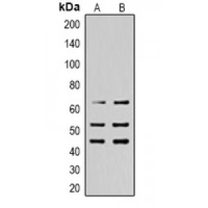 LifeSab™ SHCA (pY427) Rabbit pAb (50 µl)
