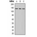 LifeSab™ HER2 Rabbit pAb (50 µl)