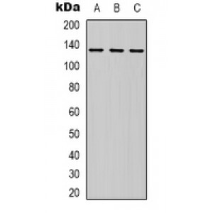 LifeSab™ HER2 Rabbit pAb (50 µl)