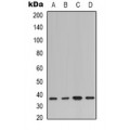 LifeSab™ GRK3 Rabbit pAb (50 µl)