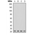 LifeSab™ Tenascin C Rabbit pAb (50 µl)