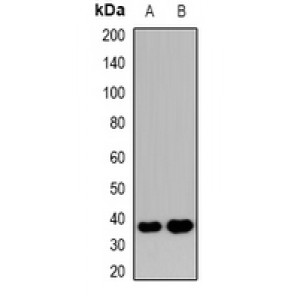 LifeSab™ SEC22B Rabbit pAb (50 µl)