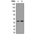 LifeSab™ Caldesmon Rabbit pAb (50 µl)