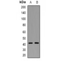 LifeSab™ Tyrosyl-tRNA Synthetase Rabbit pAb (50 µl)