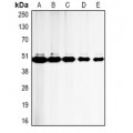 LifeSab™ CD23 Mouse mAb (50 µl)