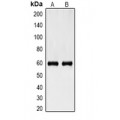 LifeSab™ Cytokeratin 8 Mouse mAb (50 µl)