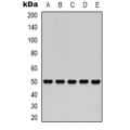 LifeSab™ Gamma-enolase Mouse mAb (50 µl)