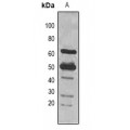 LifeSab™ Smooth Muscle Actin Mouse mAb (50 µl)