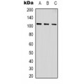 LifeSab™ AKT2 Rabbit pAb (50 µl)
