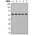 LifeSab™ AMPK alpha 1 Rabbit pAb (50 µl)