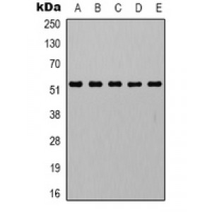 LifeSab™ AMPK alpha 1 Rabbit pAb (50 µl)