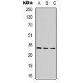 LifeSab™ CACNA2D2 Rabbit pAb (50 µl)