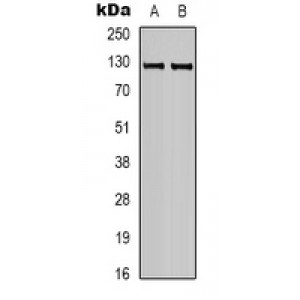 LifeSab™ CACNG2 Rabbit pAb (50 µl)