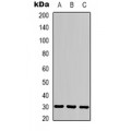 LifeSab™ CACNG5 Rabbit pAb (50 µl)