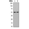 LifeSab™ GABRA4 Rabbit pAb (50 µl)