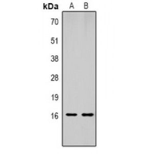 LifeSab™ Histone H1 (pT17) Rabbit pAb (50 µl)