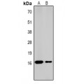LifeSab™ Histone H2A (AcK5) Rabbit pAb (50 µl)