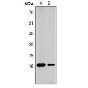 LifeSab™ Histone H2A (AcK5) Rabbit pAb (50 µl)