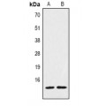 LifeSab™ Histone H2A.Z (AcK7) Rabbit pAb (50 µl)
