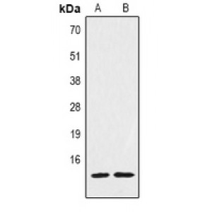 LifeSab™ Histone H2A.Z (AcK7) Rabbit pAb (50 µl)