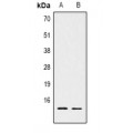LifeSab™ Histone H2B (AcK15) Rabbit pAb (50 µl)