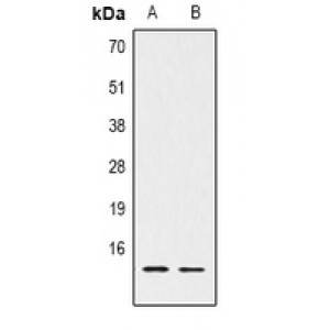 LifeSab™ Histone H2B (AcK15) Rabbit pAb (50 µl)