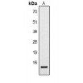 LifeSab™ Histone H2B (AcK20) Rabbit pAb (50 µl)