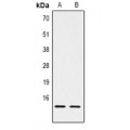LifeSab™ Histone H2B (MonoMethyl K5) Rabbit pAb (50 µl)