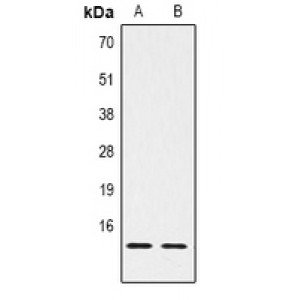 LifeSab™ Histone H2B (MonoMethyl K5) Rabbit pAb (50 µl)