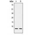 LifeSab™ Histone H2B (pS14) Rabbit pAb (50 µl)