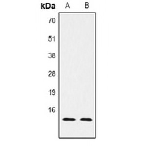 LifeSab™ Histone H2B (pS14) Rabbit pAb (50 µl)