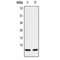 LifeSab™ Histone H3 (AcK14) Rabbit pAb (50 µl)